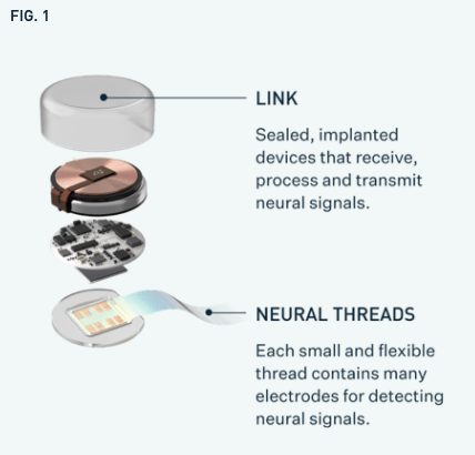 implante cerebral da Neuralink